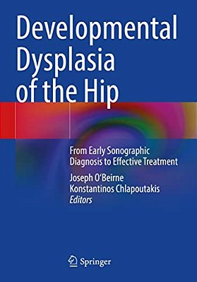 Developmental Dysplasia Of The Hip: From Early Sonographic Diagnosis To Effective Treatment-..