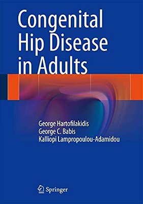 Congenital Hip Disease In Adults-..