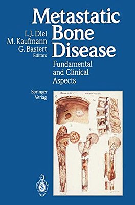 Metastatic Bone Disease: Fundamental And Clinical Aspects-..
