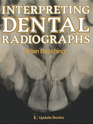 Interpreting Dental Radiographs-..