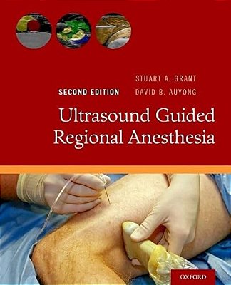 Ultrasound Guided Regional Anesthesia-..