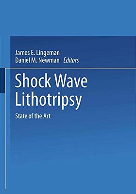 Shock Wave Lithotripsy: State Of The Art-..