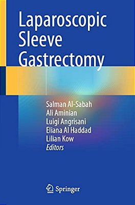 Laparoscopic Sleeve Gastrectomy-..