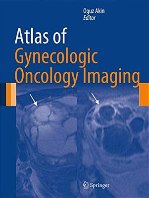 Atlas Of Gynecologic Oncology Imaging-..