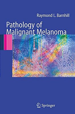 Pathology Of Malignant Melanoma-..