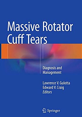 Massive Rotator Cuff Tears: Diagnosis And Management-..