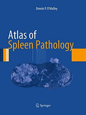 Atlas Of Spleen Pathology-..