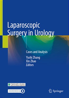 Laparoscopic Surgery In Urology: Cases And Analysis-..