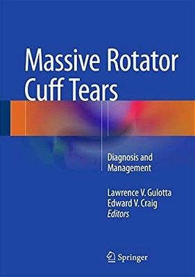 Massive Rotator Cuff Tears: Diagnosis And Management-..