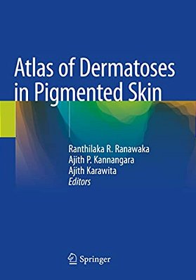 Atlas Of Dermatoses In Pigmented Skin-..