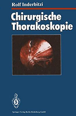 Chirurgische Thorakoskopie-..