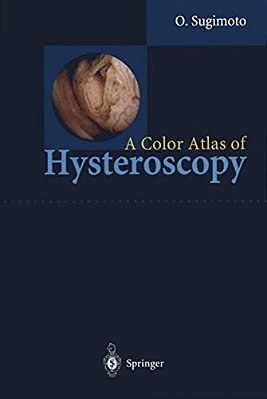 A Color Atlas Of Hysteroscopy-..