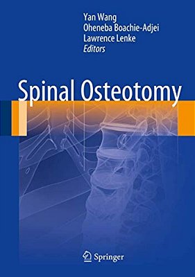 Spinal Osteotomy-..