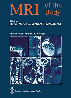 Mri Of The Body-..