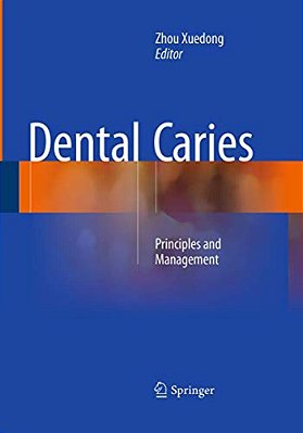 Dental Caries: Principles And Management-..