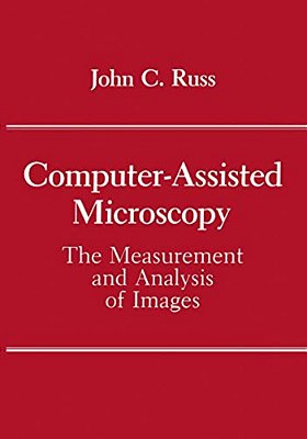 Computer-Assisted Microscopy: The Measurement And Analysis Of Images-..