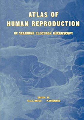 Atlas Of Human Reproduction: By Scanning Electron Microscopy-..