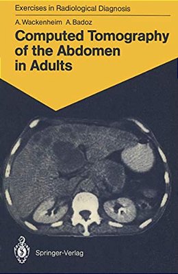Computed Tomography Of The Abdomen In Adults: 85 Radiological Exercises For Students And Practitioners-..