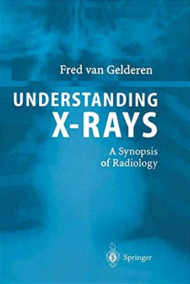 Understanding X-Rays: A Synopsis Of Radiology-..