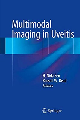 Multimodal Imaging In Uveitis-..