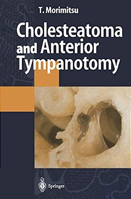 Cholesteatoma And Anterior Tympanotomy-..