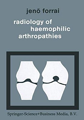 Radiology Of Haemophilic Arthropathies-..