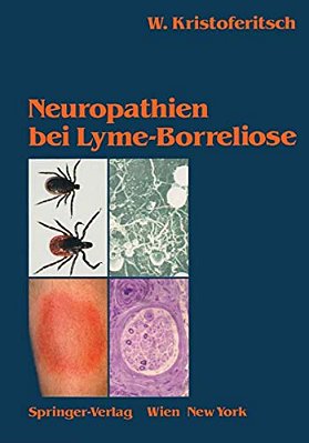 Neuropathien Bei Lyme-Borreliose-..