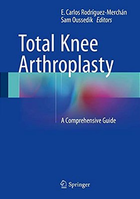 Total Knee Arthroplasty: A Comprehensive Guide-..