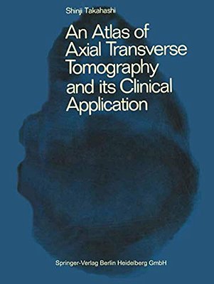 An Atlas Of Axial Transverse Tomography And Its Clinical Application-..