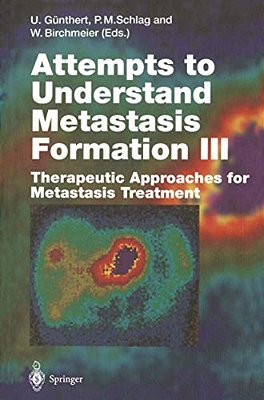 Attempts To Understand Metastasis Formation III: Therapeutic Approaches For Metastasis Treatment-..