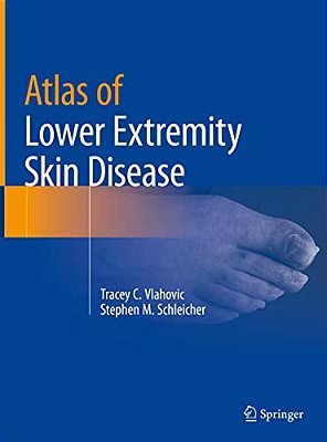 Atlas Of Lower Extremity Skin Disease-..