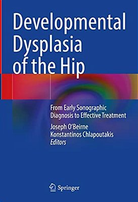Developmental Dysplasia Of The Hip: From Early Sonographic Diagnosis To Effective Treatment-..