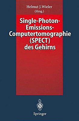 Single-Photon-emissions-computertomographie (Spect) Des Gehirns-..