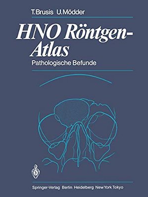 Hno Röntgen-Atlas: Pathologische Befunde-..