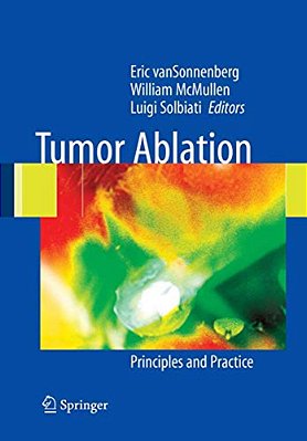 Tumor Ablation: Principles And Practice-..