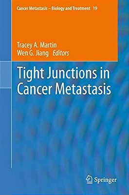 Tight Junctions In Cancer Metastasis-..