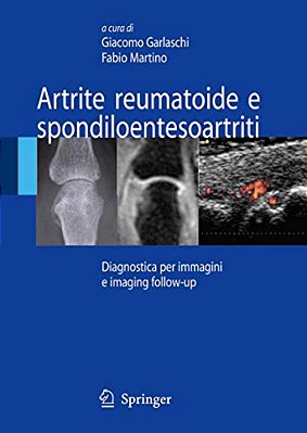 Artrite Reumatoide E Spondiloentesoartriti: Diagnostica Per Immagini Ed Imaging Follow-Up-..