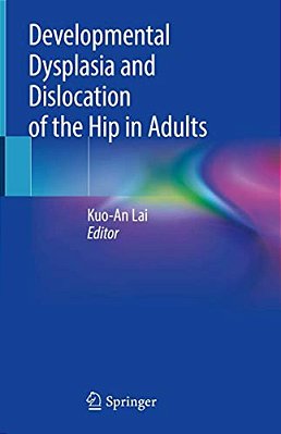 Developmental Dysplasia And Dislocation Of The Hip In Adults-..