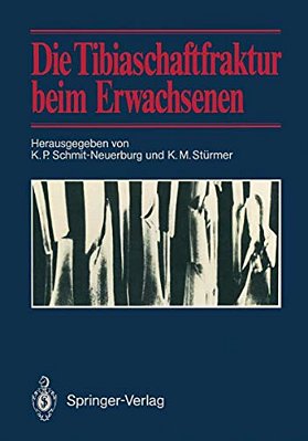 Die Tibiaschaftfraktur Beim Erwachsenen: Symposium Anläßlich Des 10Jährigen Bestehens Der Abteilung Für Unfallchirurgie Am Klinikum Essen, 1./2. Febru-..