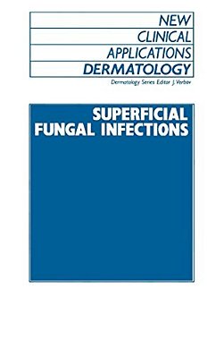 Superficial Fungal Infections-..