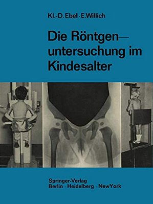 Die Röntgenuntersuchung Im Kindesalter: Technik Und Indikation-..