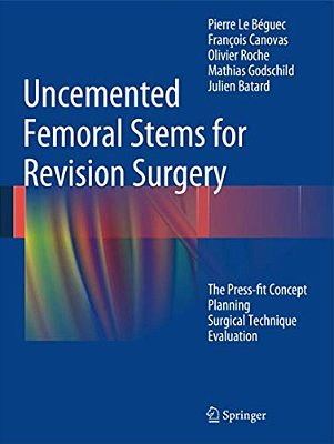 Uncemented Femoral Stems For Revision Surgery: The Press-Fit Concept - Planning - Surgical Technique - Evaluation-..