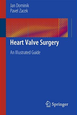 Heart Valve Surgery: An Illustrated Guide-..