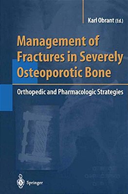 Management Of Fractures In Severely Osteoporotic Bone: Orthopedic And Pharmacologic Strategies-..