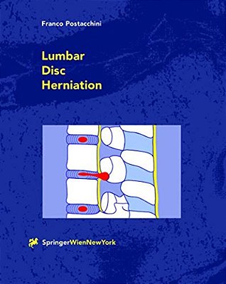 Lumbar Disc Herniation-..