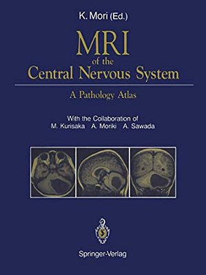 Mri Of The Central Nervous System: A Pathology Atlas-..