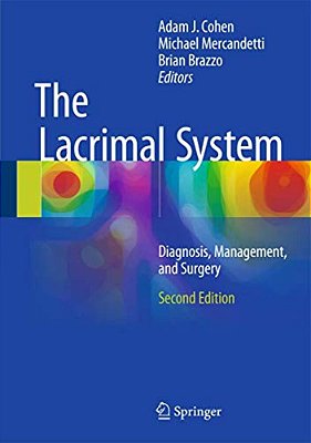 The Lacrimal System: Diagnosis, Management, And Surgery, Second Edition-..