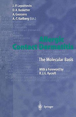 Allergic Contact Dermatitis: The Molecular Basis-..