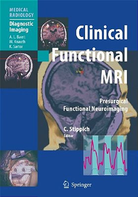 Clinical Functional Mri: Presurgical Functional Neuroimaging-..