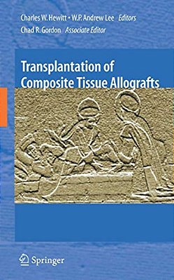 Transplantation Of Composite Tissue Allografts-..